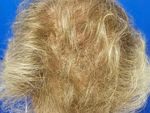 64 YEAR-OLD FEMALE. DAILY USE HAIR GROWTH GUMMIES