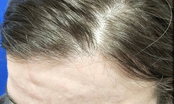43 YEAR-OLD FEMALE. DAILY USE HAIR GROWTH GUMMIES