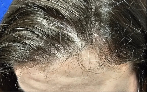 43 YEAR-OLD FEMALE. DAILY USE HAIR GROWTH GUMMIES